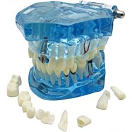 Model chrupu, zubních implantátů